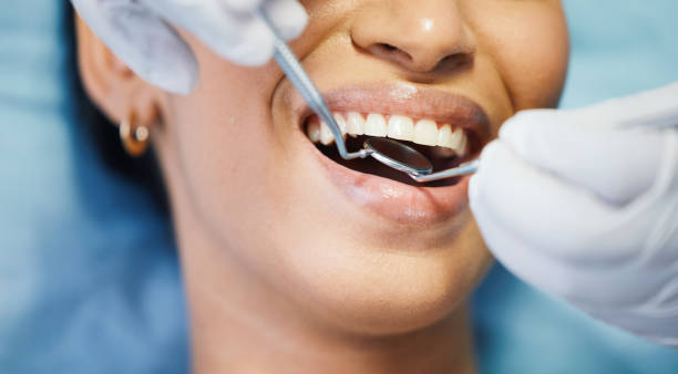 Best Emergency Root Canal Therapy in Franklin, NH